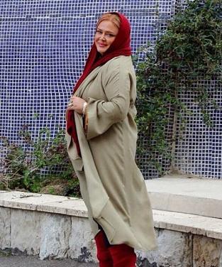 عکس بهاره رهنما بعد عمل