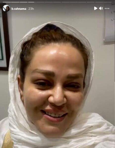 عکس بهاره رهنما بعد عمل