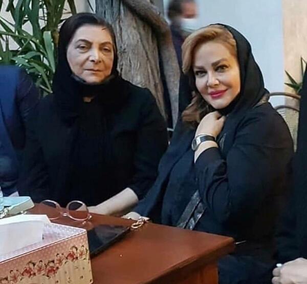 عکس بهاره رهنما بعد عمل