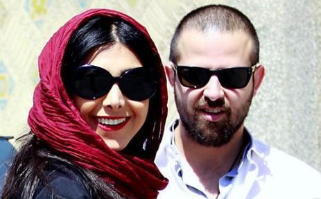 عکس ازاده صمدی قبل عمل بینی