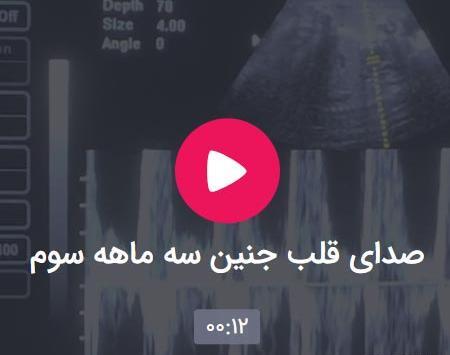 عکس قلب جنین در هفته هفتم