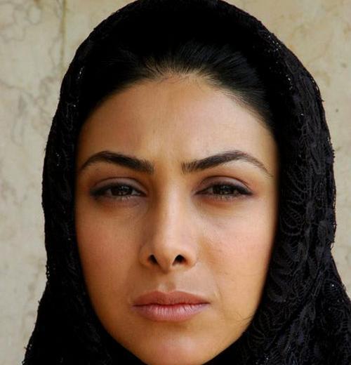 عکسهای آزاده صمدی قبل از عمل زیبایی