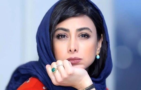 عکسهای آزاده صمدی قبل از عمل زیبایی