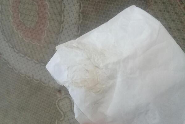عکس خونه لانه گزینی