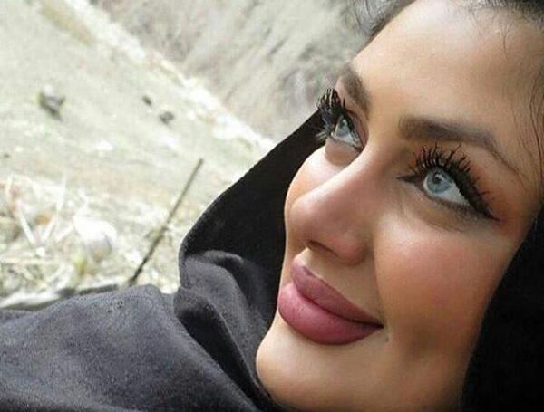 عکسهای قبل عمل غزاله میر