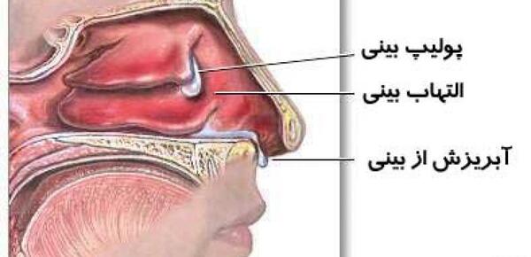 عکس داخل بینی انسان