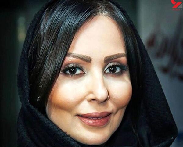 عکس کاشت ابرو پرستو صالحی
