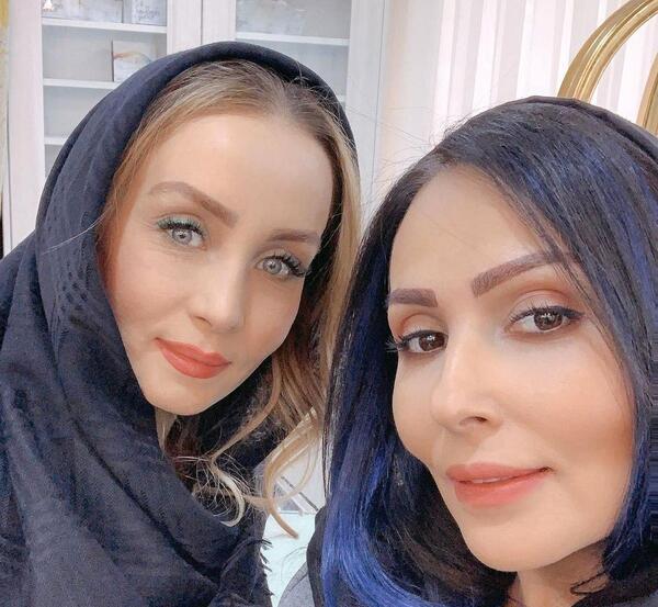 عکس کاشت ابرو پرستو صالحی
