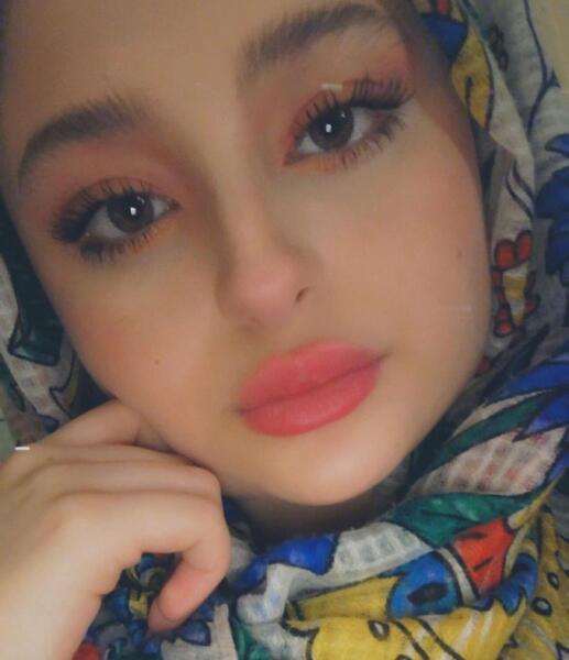 عکس سارا و نیکا قبل از عمل زیبایی