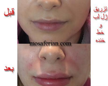 عکس لب اردکی
