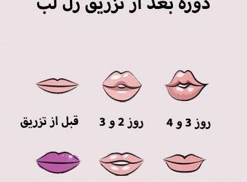 عکس لب اردکی