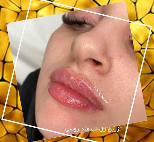 عکس لب اردکی