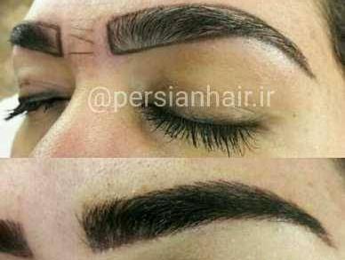 عکس کاشت ابرو طبیعی