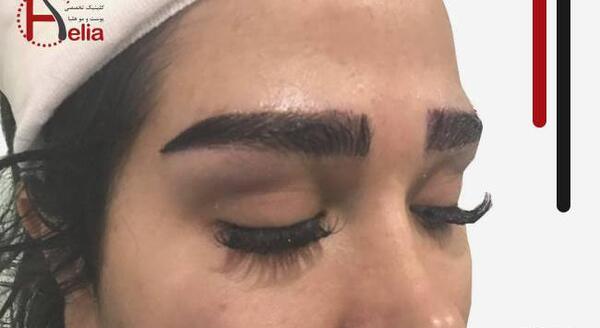 عکس کاشت ابرو طبیعی