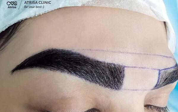 عکس کاشت ابرو طبیعی