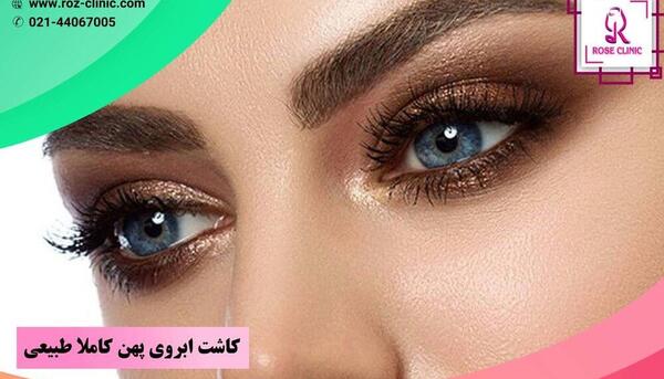 عکس کاشت ابرو طبیعی
