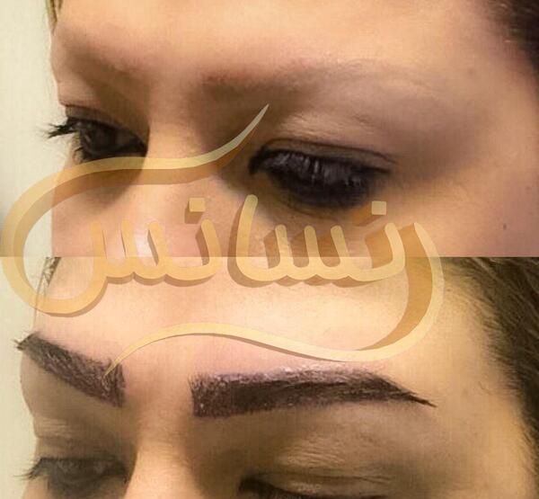 عکس کاشت ابرو طبیعی