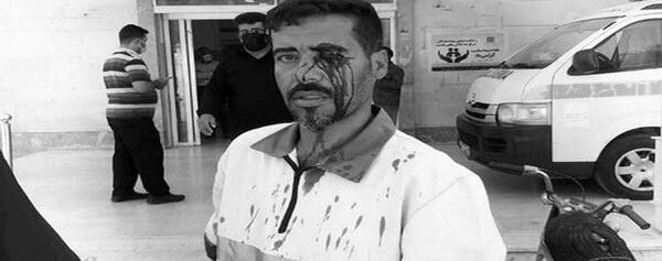 عکس چت خاص