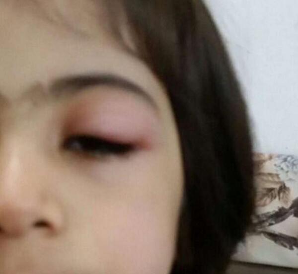 عکس زیباترین پشه