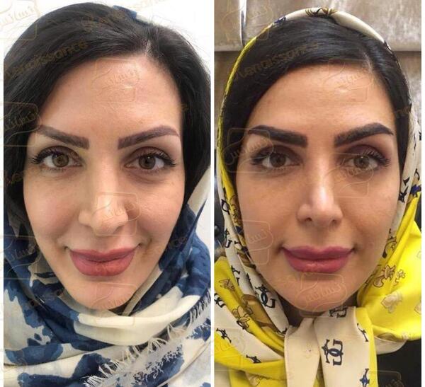 عکس ابرو نی نی سایت
