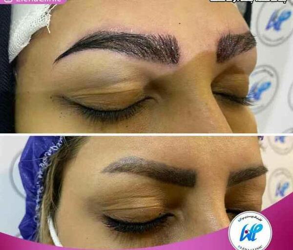 عکس ابرو نی نی سایت