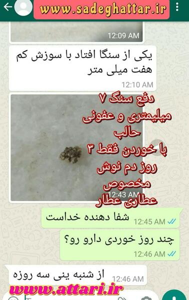 عکس سنگ کلیه 4 میلیمتری
