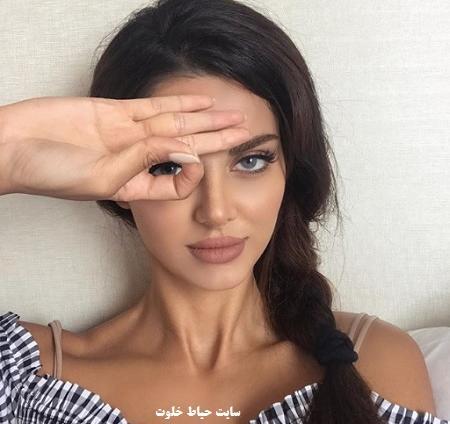 عکس قبل عمل مه لقا جابری