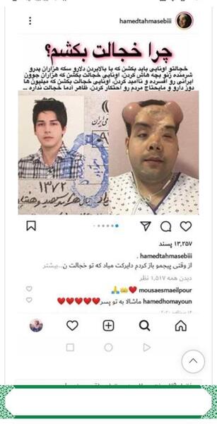 عکس قبل تصادف حامد طهماسبی زندگی پس از زندگی
