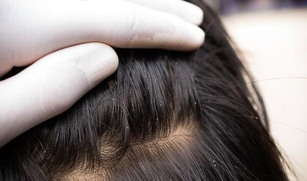 عکس عروسک شپش