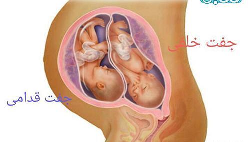 عکس خاک بر سری یعنی چه