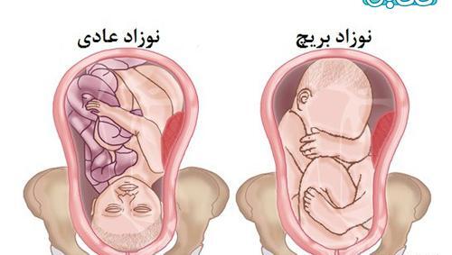عکس خاک بر سری یعنی چه