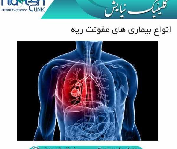 عکس ریه چرکی