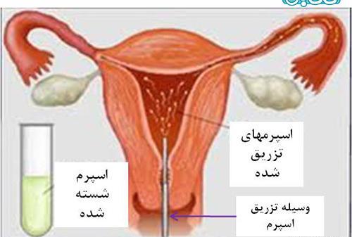 عکس ریه چگونه انجام میشود