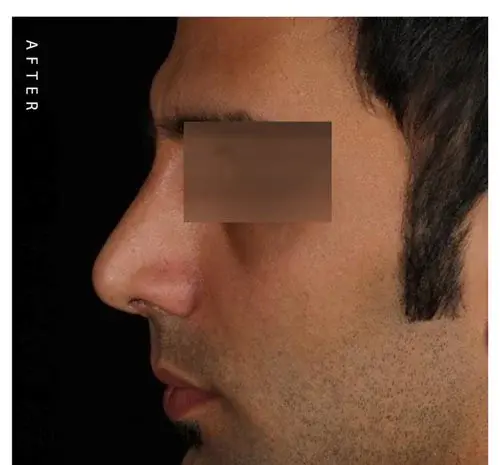 عکس داخل دماغ