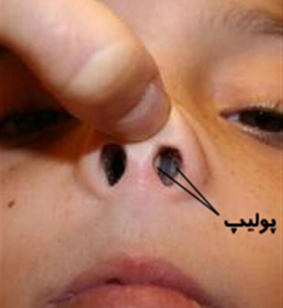 عکس داخل دماغ