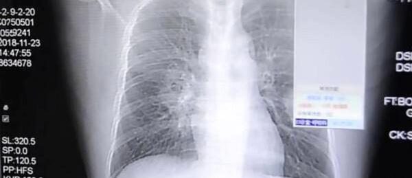 عکس ریه خیابان پیروزی