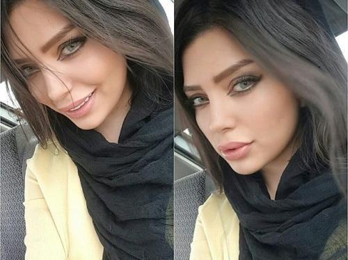 عکس قدیمی نیلوفر بهبودی