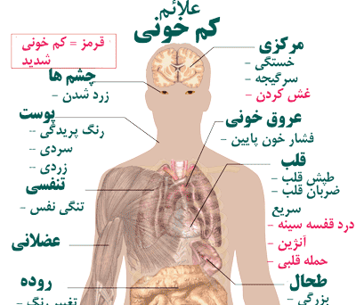 عکس سنگ خونی