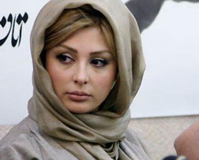 عکس پروتز لب نیوشا ضیغمی