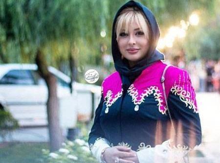 عکس پروتز لب نیوشا ضیغمی
