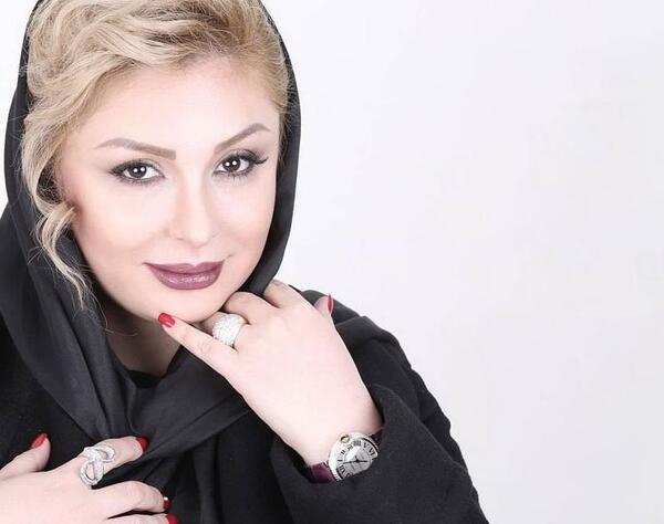 عکس پروتز لب نیوشا ضیغمی