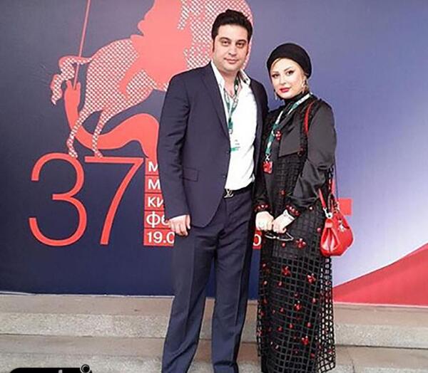 عکس پروتز لب نیوشا ضیغمی