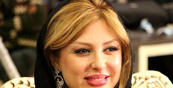 عکس پروتز لب نیوشا ضیغمی