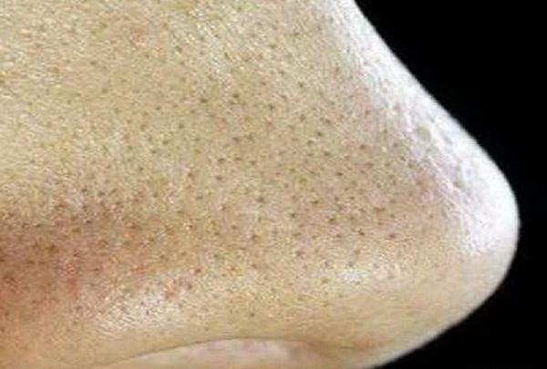 عکس دانه های سر سیاه