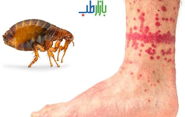 عکس پشه کک