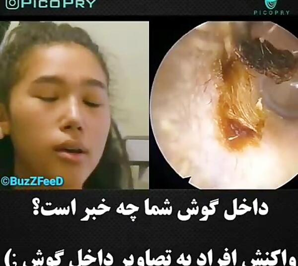 عکس داخل گوش انسان
