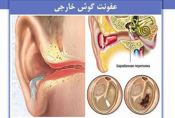 عکس داخل گوش انسان