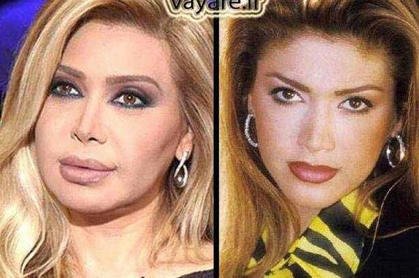 عکس قدیمی نوال الزغبی
