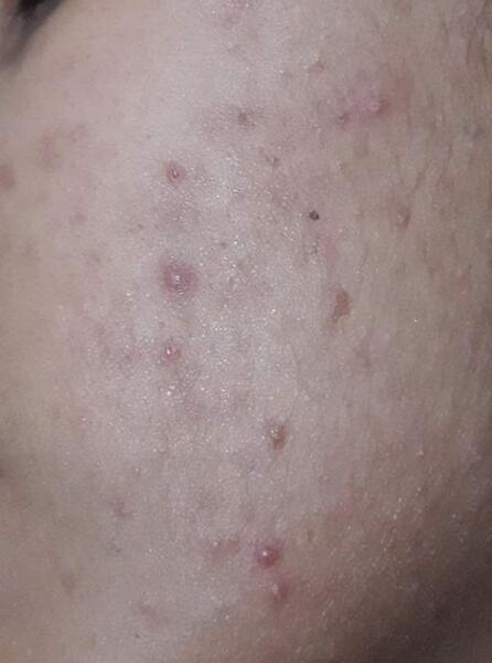 عکس ژیلت نی نی سایت