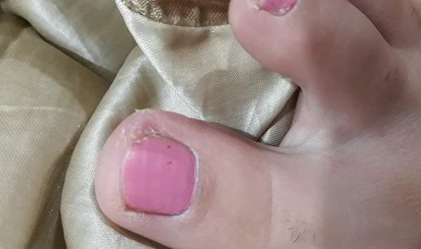 عکس ناخن پا نی نی سایت